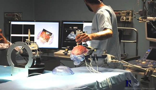robotic-neurosurgery-brain