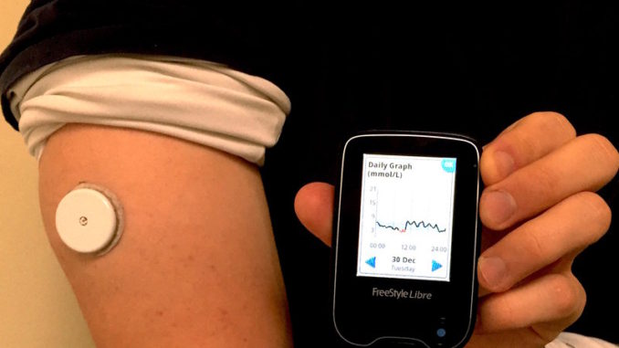 freestyle libre flash glucose monitoring system reviews