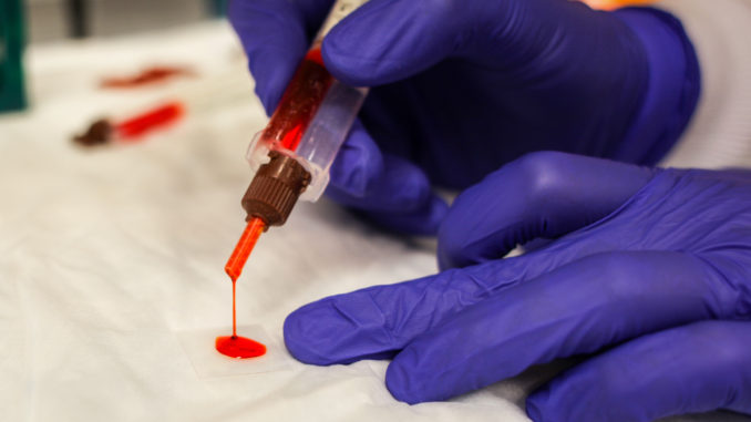 MIT-Tissue-Glue-02-press