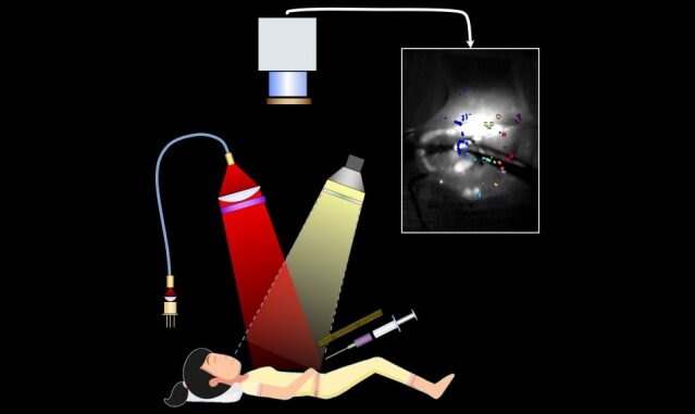 MIT-Cancer-Surgery_0